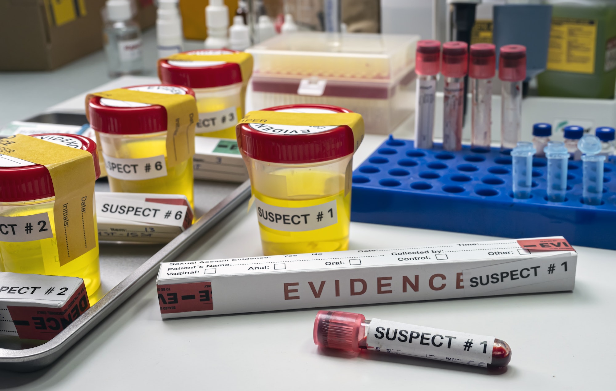 Various analyses of urine, saliva and blood of homicide suspects in crime lab, conceptual image.